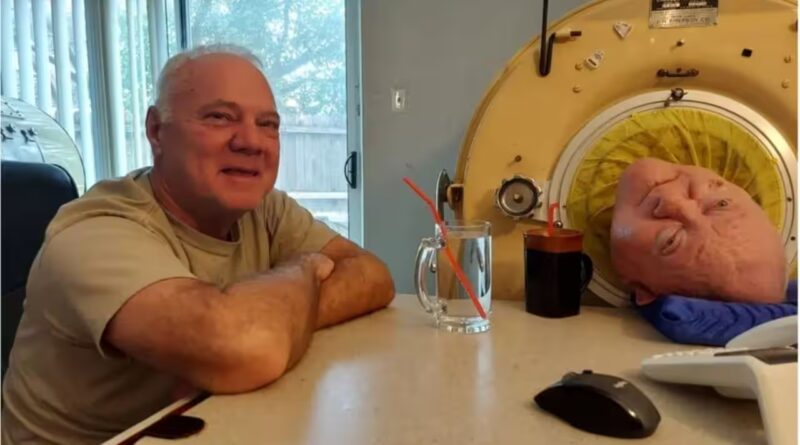 A six-year-old entered an iron lung after polio. More than 70 years later, he had become the world’s longest-known survivor | World News