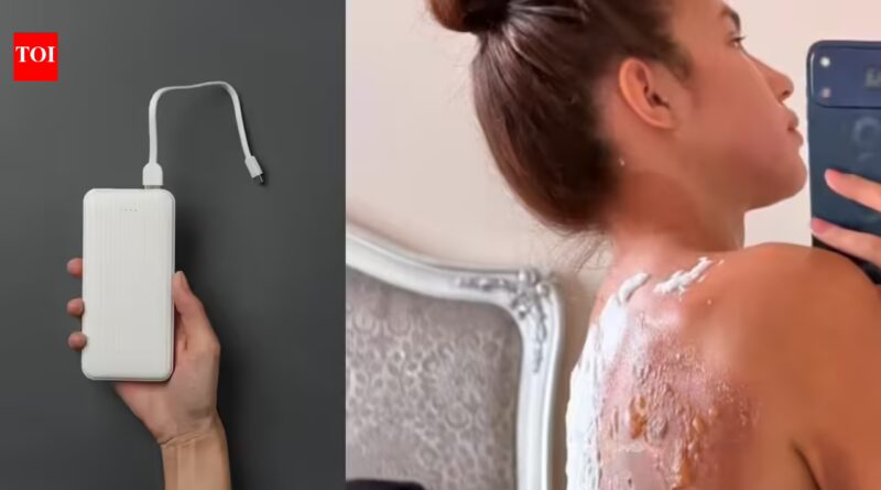 Fortune teller fails to foresee horror: Power bank explodes as she sleeps, leaving her burned
