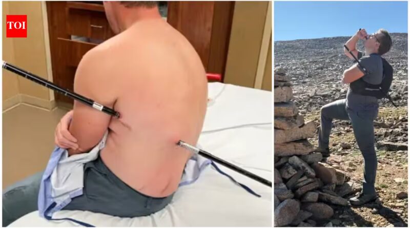 A man impales himself on trekking pole while climbing Montana's highest peak, hikes 10 miles to safety instead of calling a helicopter